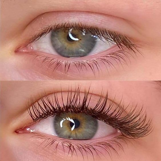 Ibeauty Ultra Super Glue 5ml, 1-2 Sec Drying Time, 5-6 Weeks, Professional Eyelash Extension - Image 11