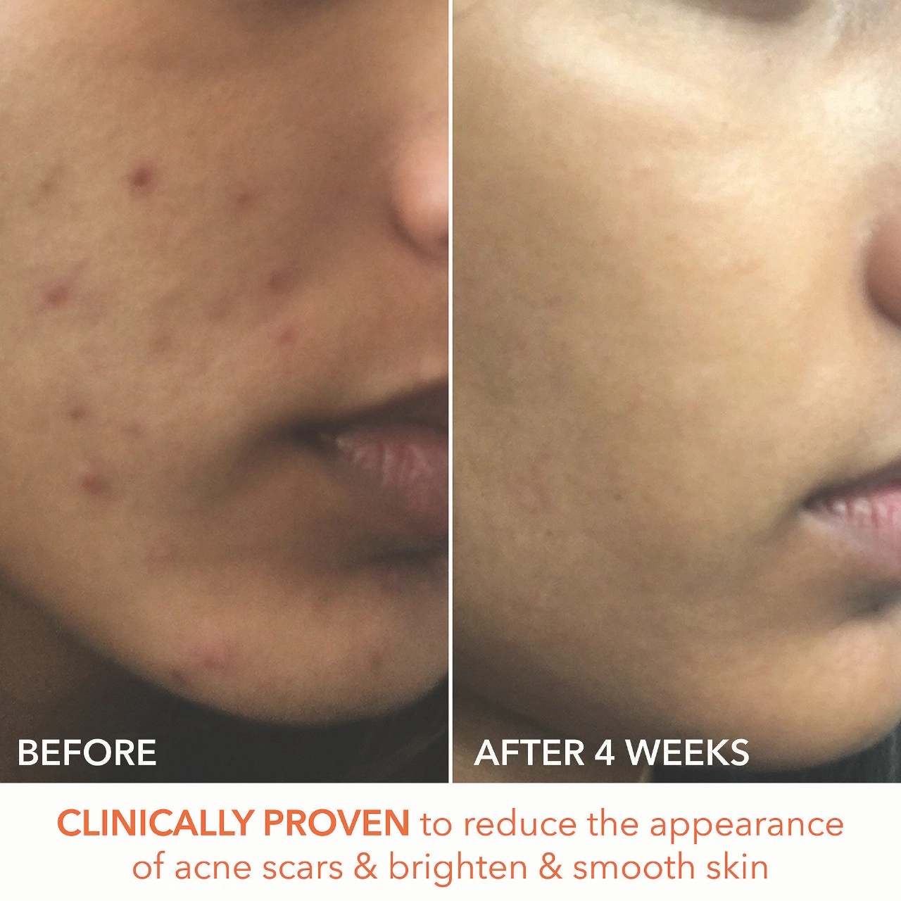 Dr. Dennis Gross Skincare Alpha Beta® Extra Strength Daily Peel Pads 30 Treatments + 5 Bonus - Image 9