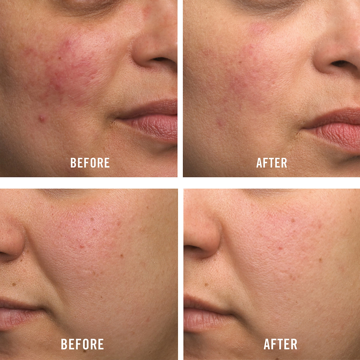 First Aid Beauty Ultra Repair® Cream Intense Hydration - 2 oz/ 60 mL - Image 4