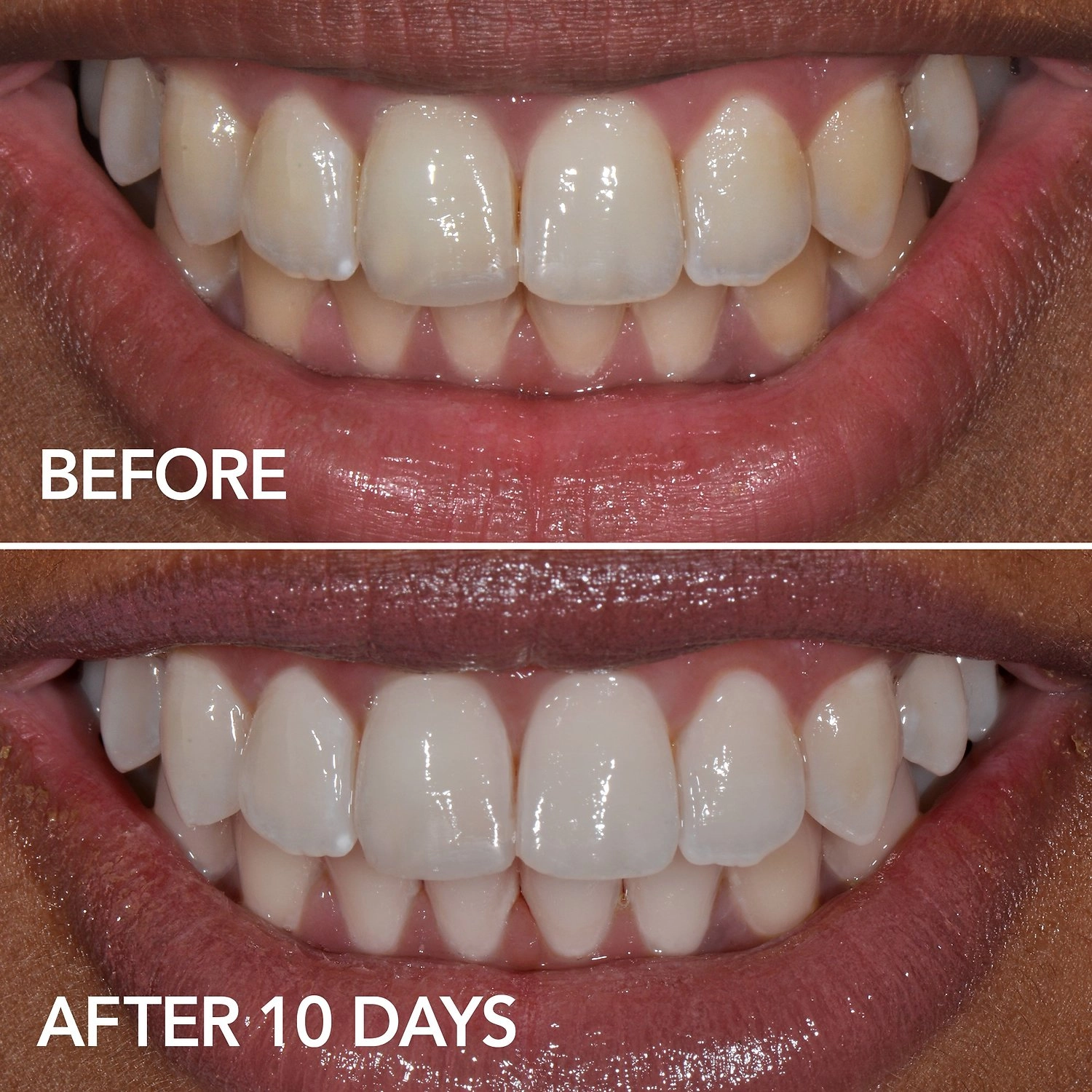 GLO Science GLO Brilliant Teeth Whitening GLO Vials 10 Pack plus Lip Care - Image 2