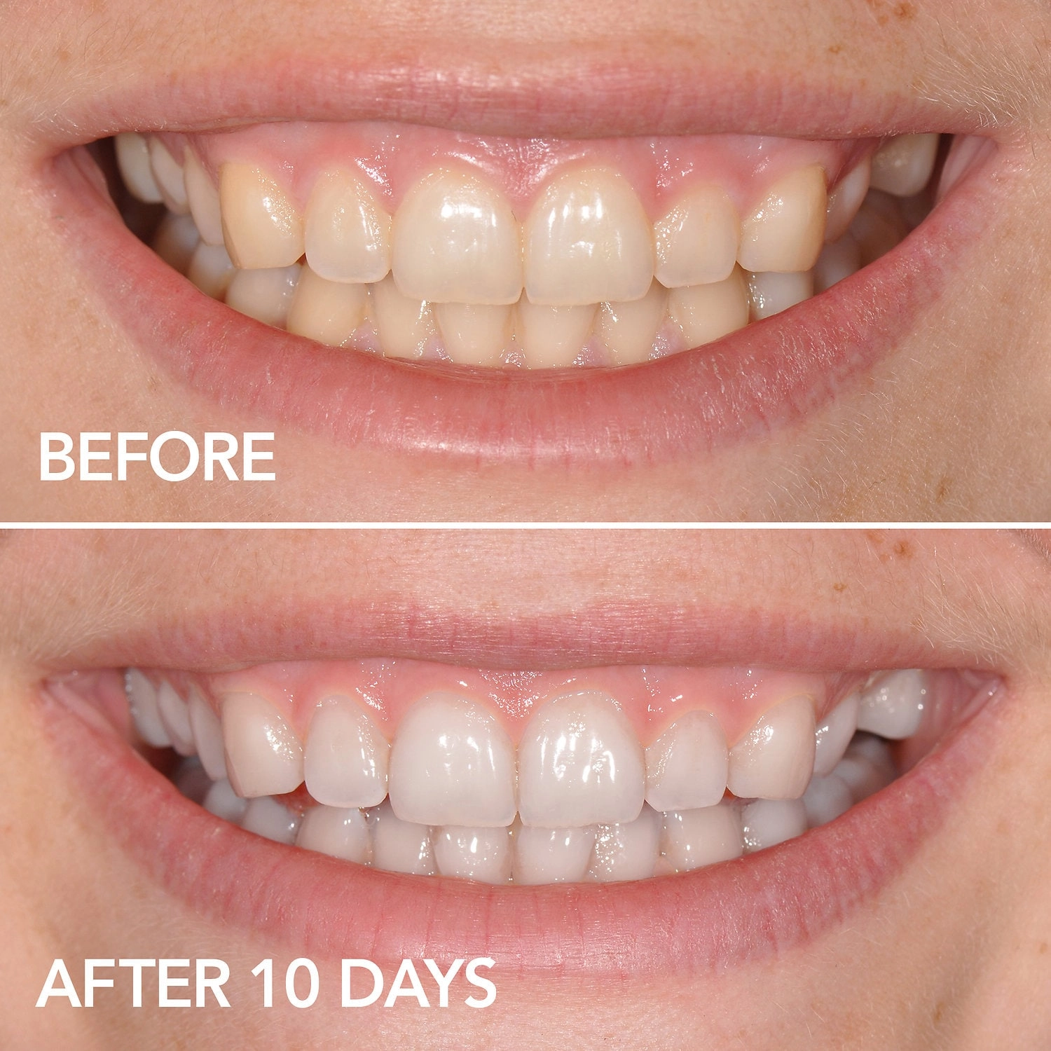 GLO Science GLO Brilliant Teeth Whitening GLO Vials 10 Pack plus Lip Care - Image 3