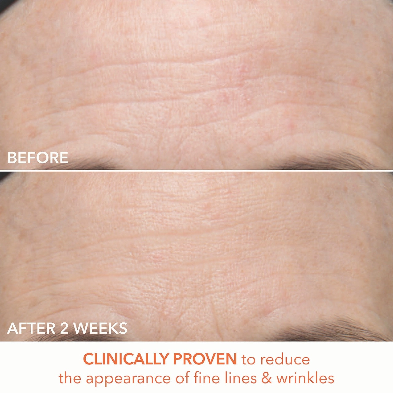 Dr. Dennis Gross Skincare Alpha Beta® Ultra Gentle Daily Peel Pads for Sensitive Skin - 30 treatments + 5 bonus - Image 3