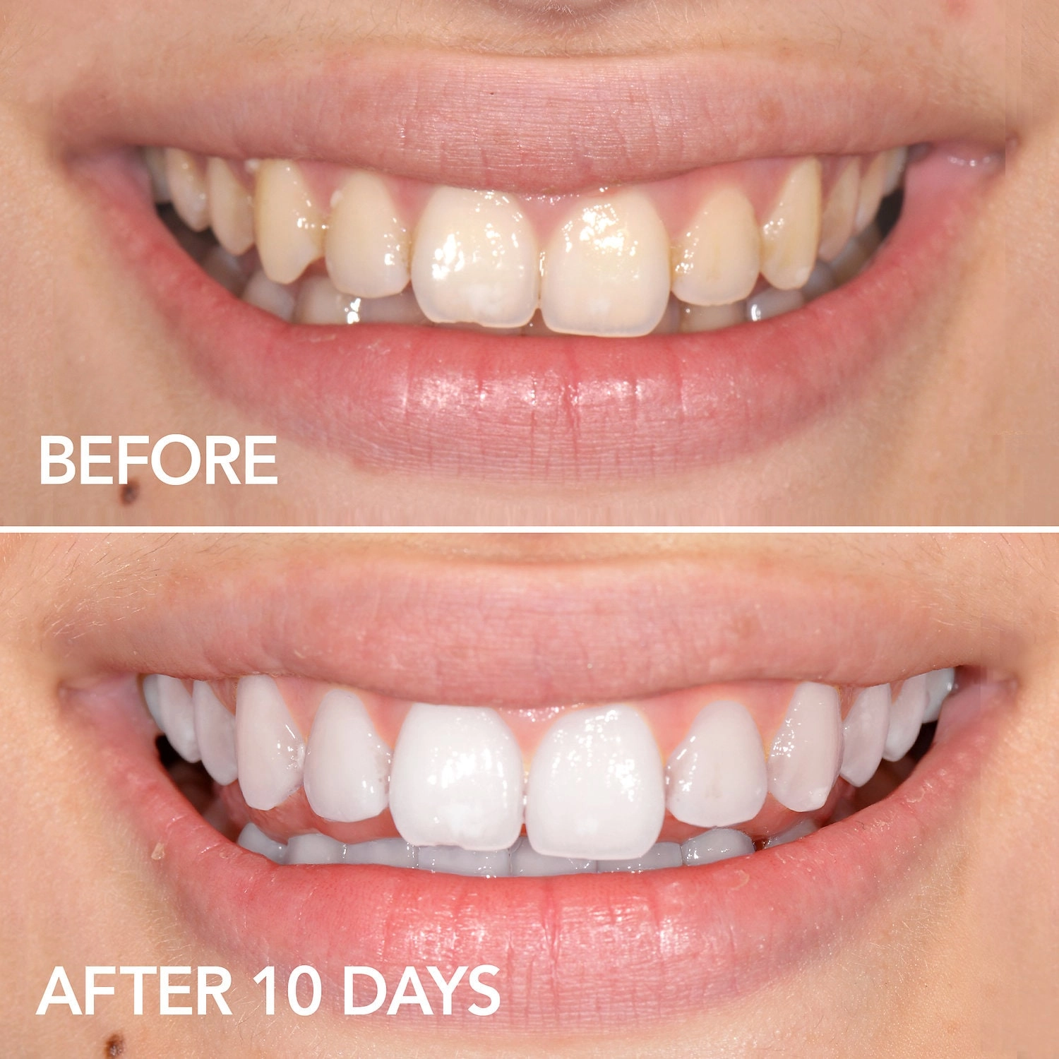 GLO Science GLO Lit™ Teeth Whitening Vials 7 Pack + Lip Care - Image 2