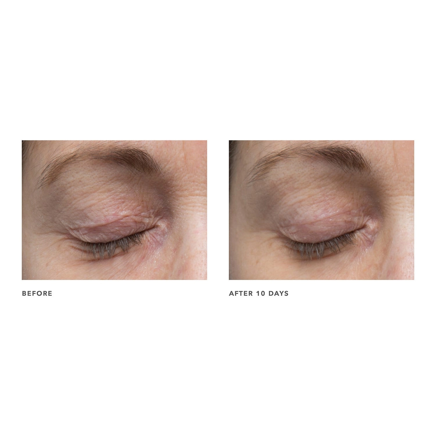 Algenist POWER Advanced Wrinkle Fighter 360° Eye Serum 0.5 oz/15 mL - Image 2