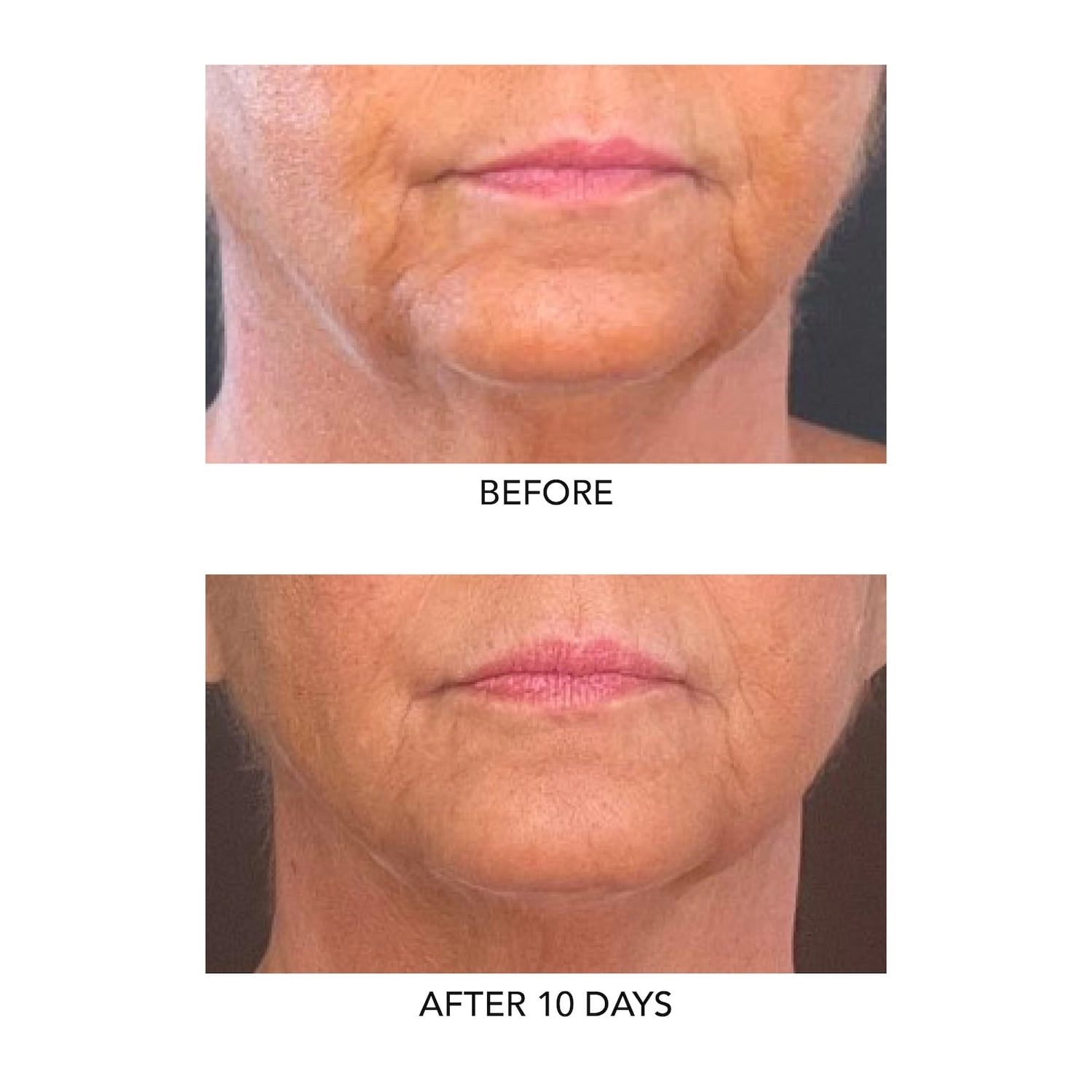 Algenist GENIUS Liquid Collagen® Serum - 0.21 oz/6.2 mL - Vegan - Loss of Firmness - Hypoallergenic - Without Parabens - Image 13