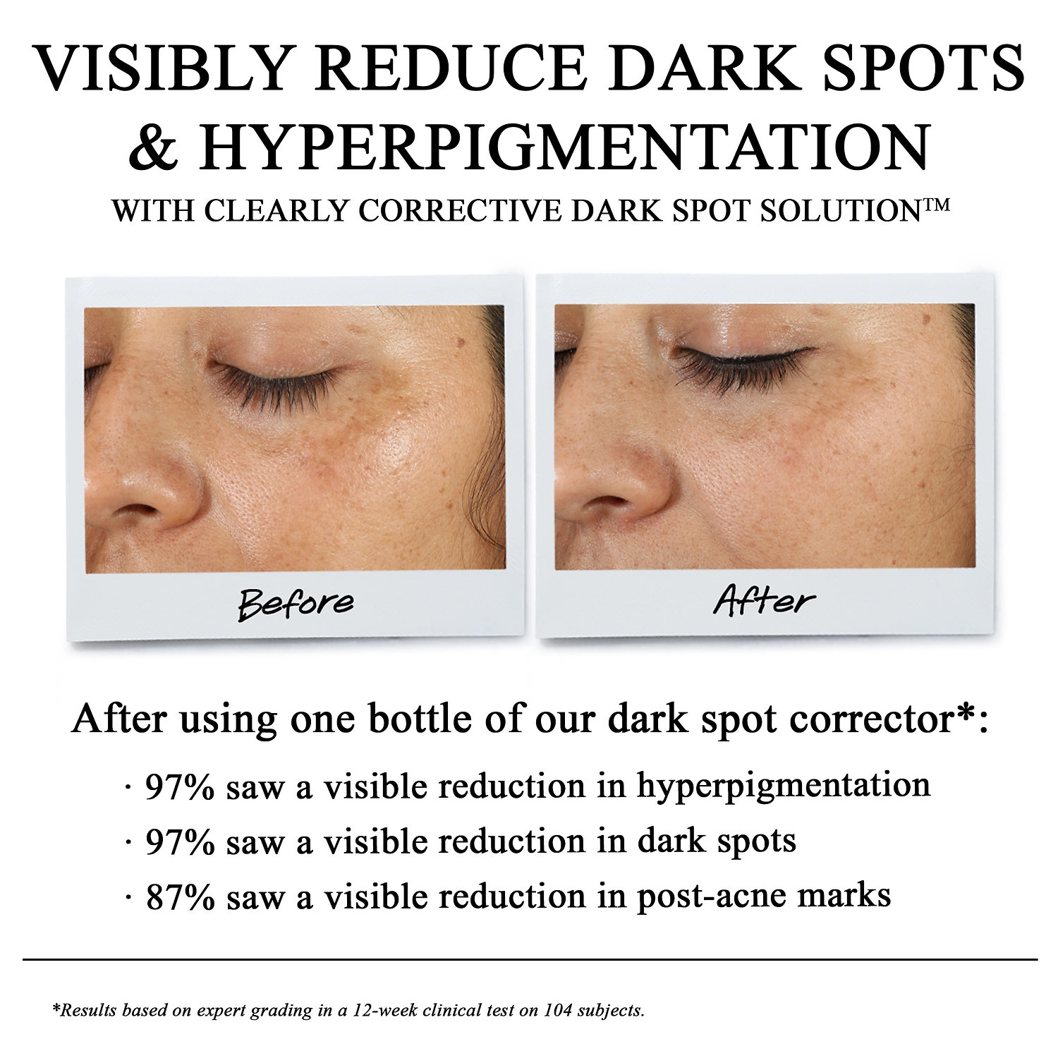 Kiehl's Since 1851 Clearly Corrective Dark Spot Correcting Serum 0.5 oz/ 15 mL - Image 2