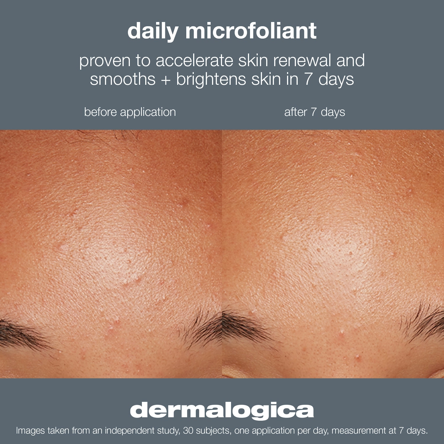 Dermalogica Daily Microfoliant Exfoliator 2.6 oz/74g Vegan - Image 4