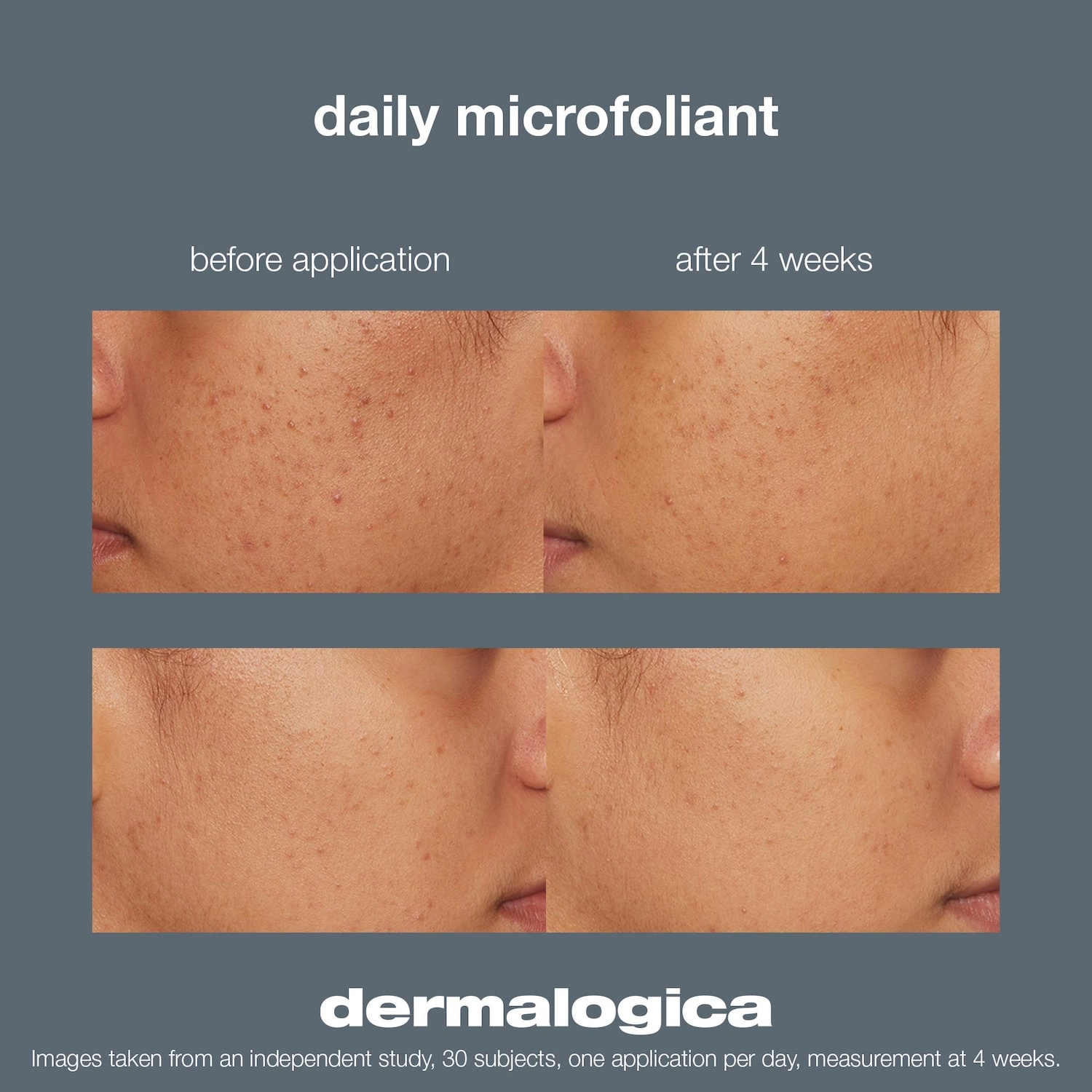 Dermalogica Daily Microfoliant Exfoliator 2.6 oz/74g Vegan - Image 3