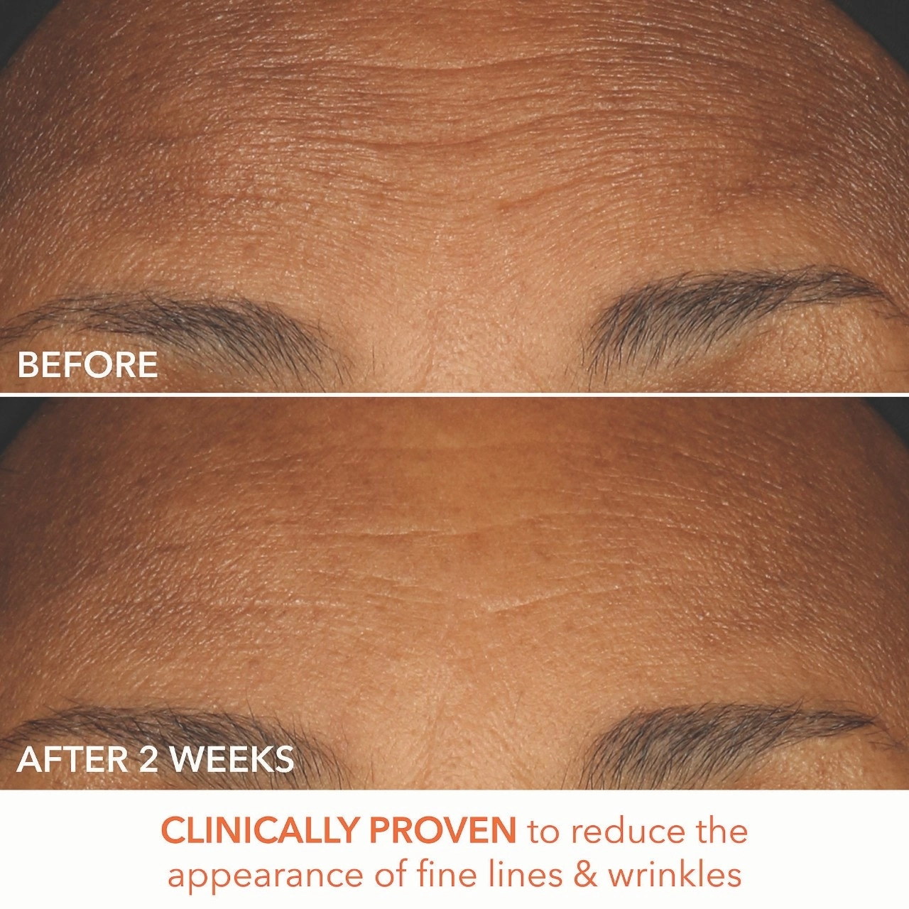 Dr. Dennis Gross Skincare Mini Alpha Beta® Extra Strength Daily Peel Pads - Size: 5 Treatments - Image 20