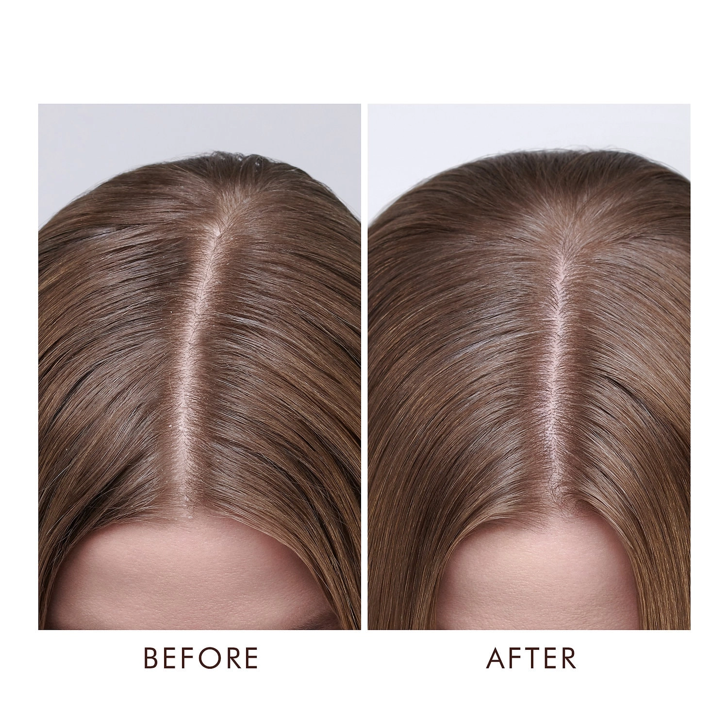 Moroccanoil Dry Scalp Treatment 1.5 oz/45 mL - Salicylic Acid - Good for Flaky/Dry Scalp - Image 2