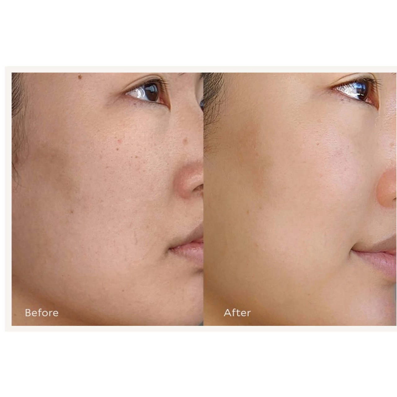 Tata Harper Resurfacing & Brightening AHA + BHA Serum with Vitamin C - 1 oz/30 mL - Image 4
