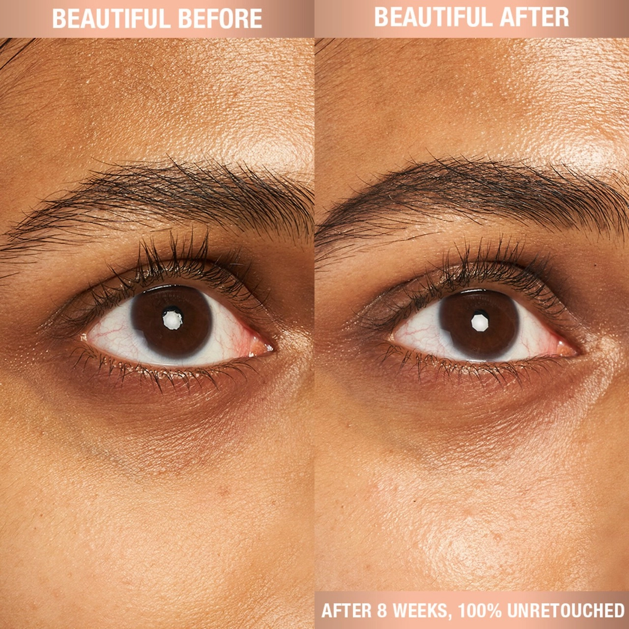 Charlotte Tilbury Charlotte’s Magic Eye Cream with Retinol - Dark Circles, Anti-Aging - 0.5 oz/15 mL Refill - Image 2