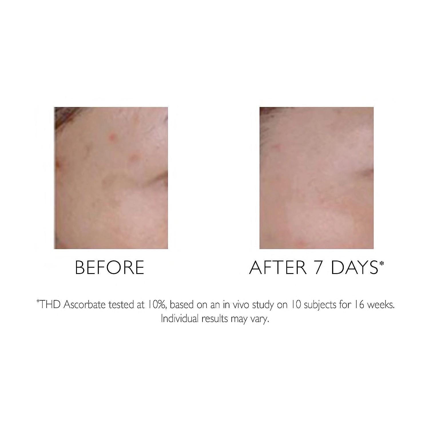 Peter Thomas Roth Potent-C™ Targeted Spot Brightener - Image 4