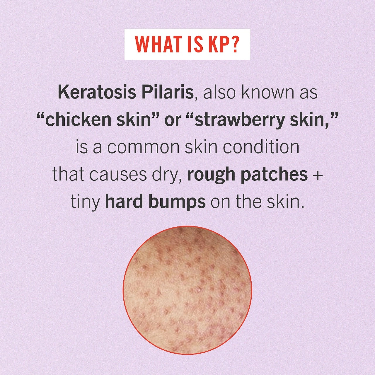 First Aid Beauty Mini KP Bump Eraser Body Scrub with 10% AHA 2 oz/ 56.7 g Fragrance Free - Image 10