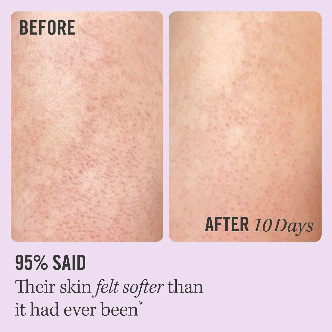 First Aid Beauty KP Bump Eraser Body Scrub with 10% AHA, Size: 2 oz/ 56.7 g - Image 12