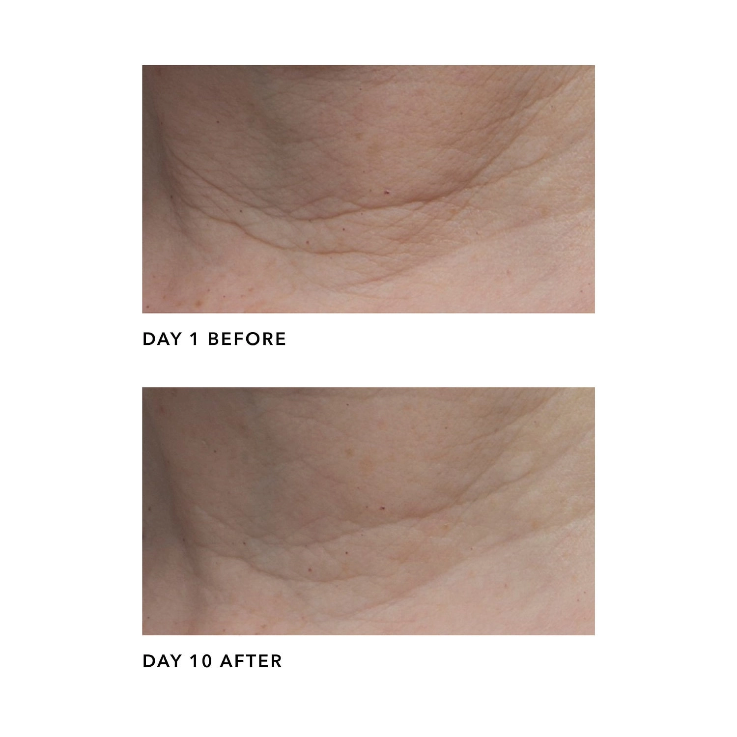 Algenist ELEVATE Firming & Lifting Neck Cream 2 oz/ 60 mL Vegan Retinol Hypoallergenic - Image 3