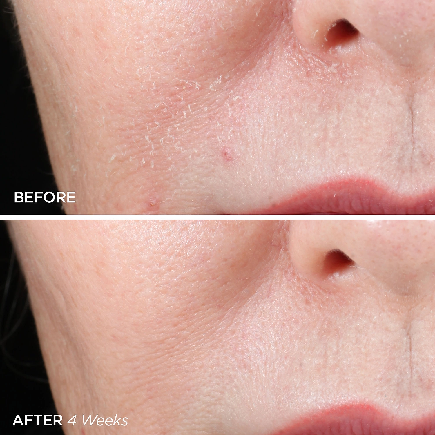 BeautyBio The ZenBubble Gel Cream 1.7 oz/50 mL - Redness, Pores, Acne/Blemishes - Image 2