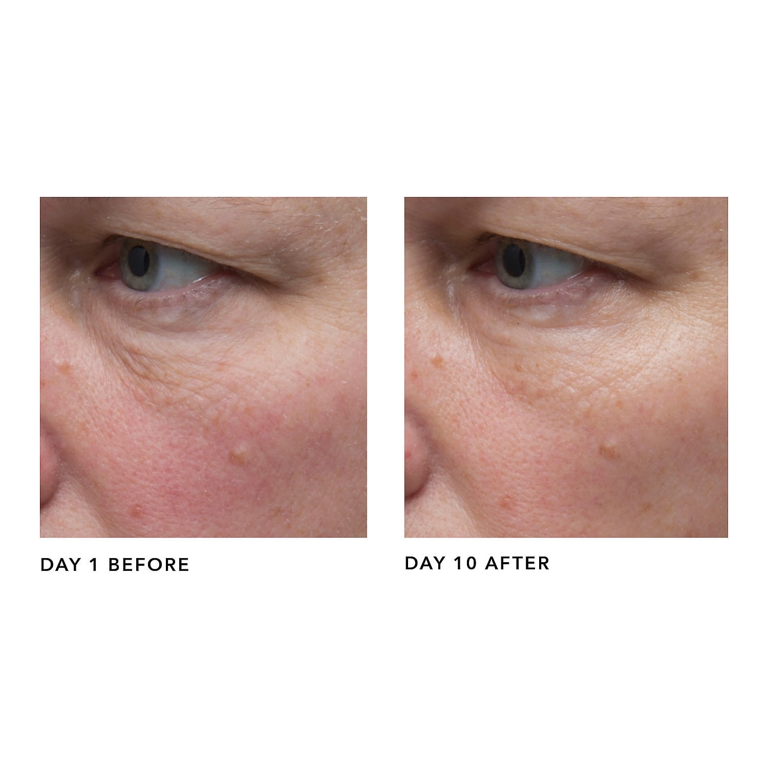 Algenist GENIUS Liquid Collagen® Serum - 0.21 oz/6.2 mL - Vegan - Loss of Firmness - Hypoallergenic - Without Parabens - Image 5
