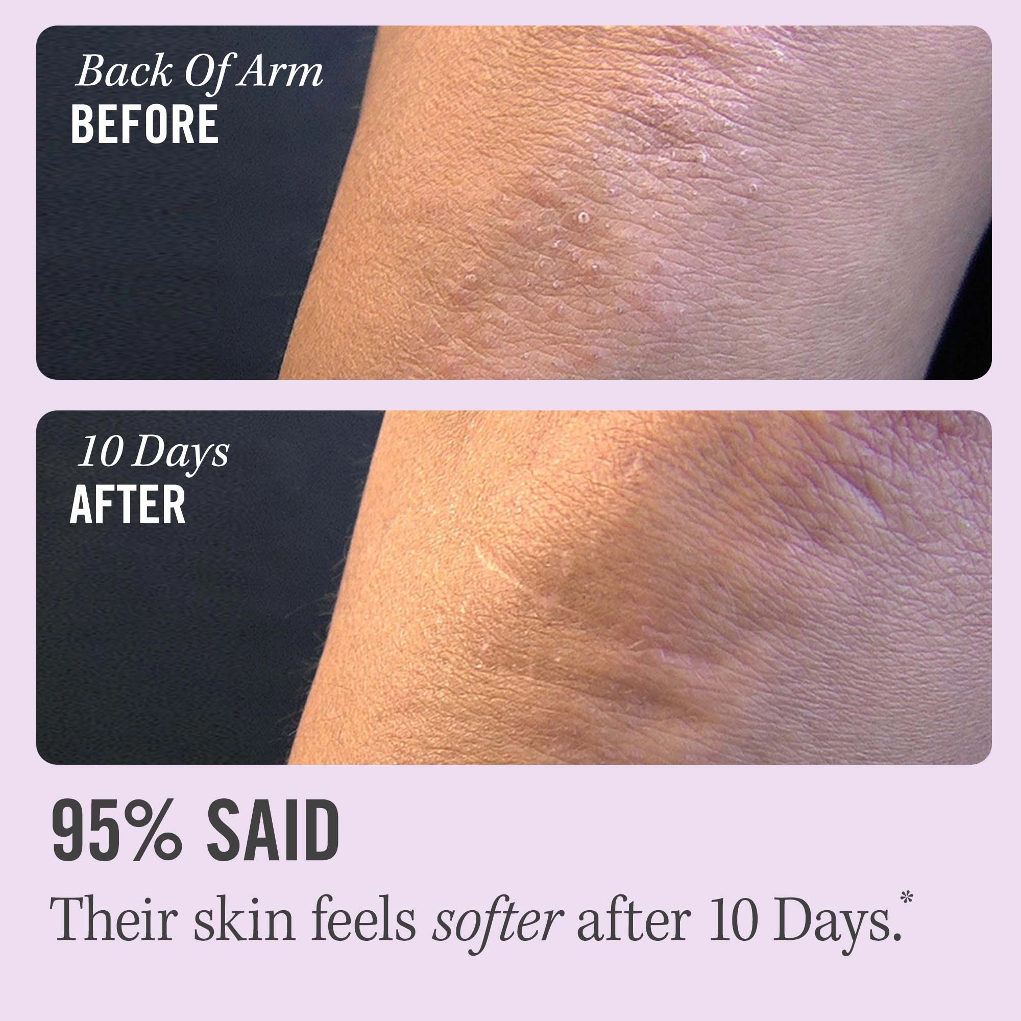 First Aid Beauty Mini KP Bump Eraser Body Scrub with 10% AHA 2 oz/ 56.7 g Fragrance Free - Image 3