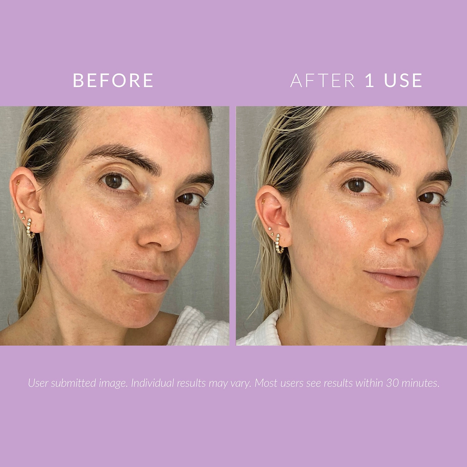 Kate Somerville DeliKate™ Recovery Cream 1.7 oz/50 mL - Redness, Dark Circles, Dryness - Image 2