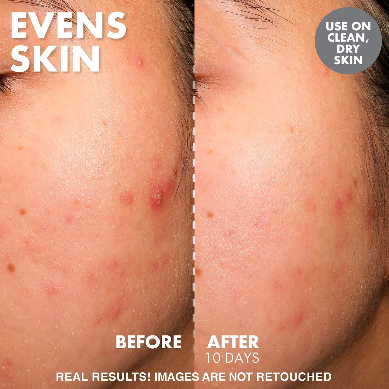 Wishful Yo Glow AHA & BHA Facial Enzyme Scrub - Image 3