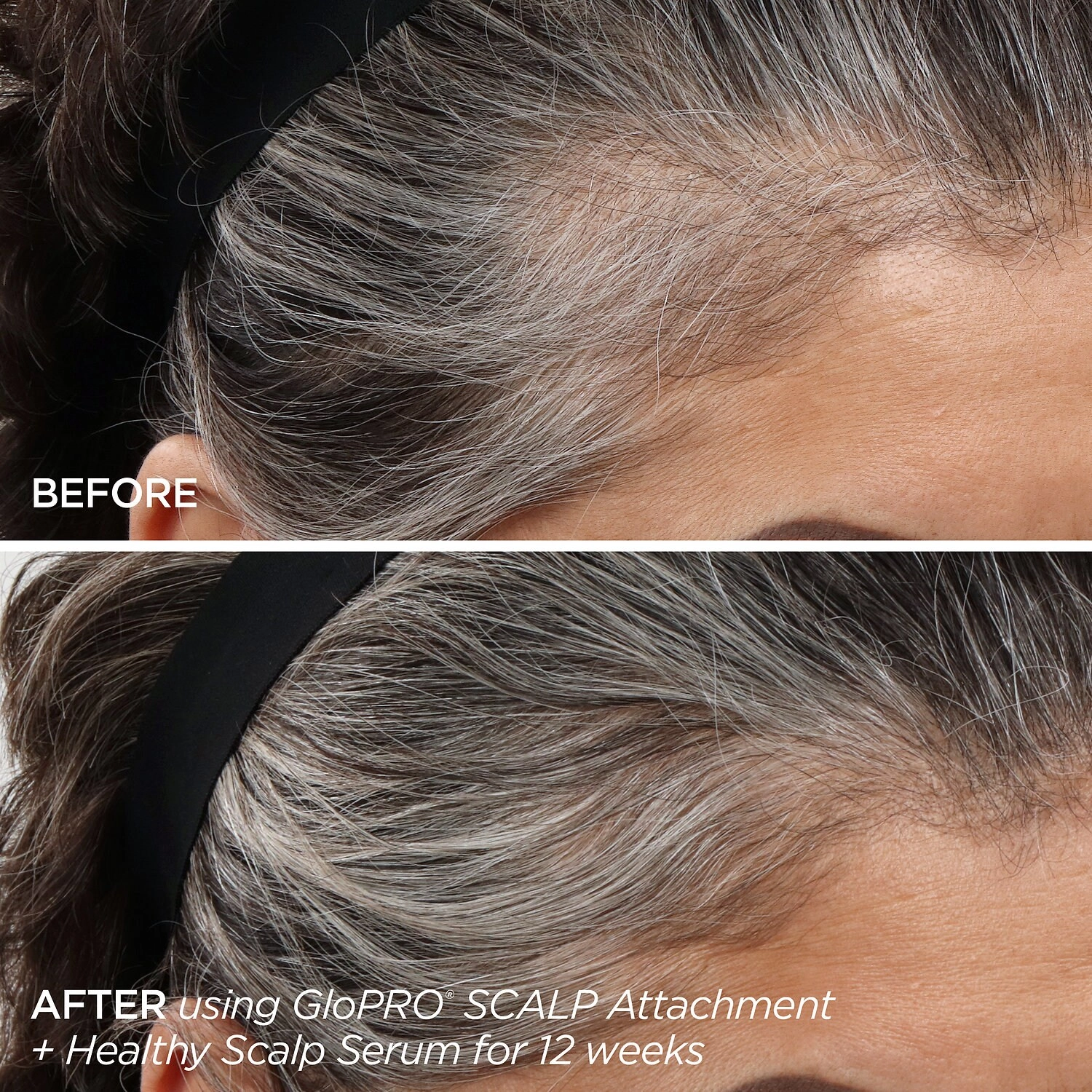 BeautyBio Rejuvenating Scalp + Fuller Hair Therapy Set - Image 3