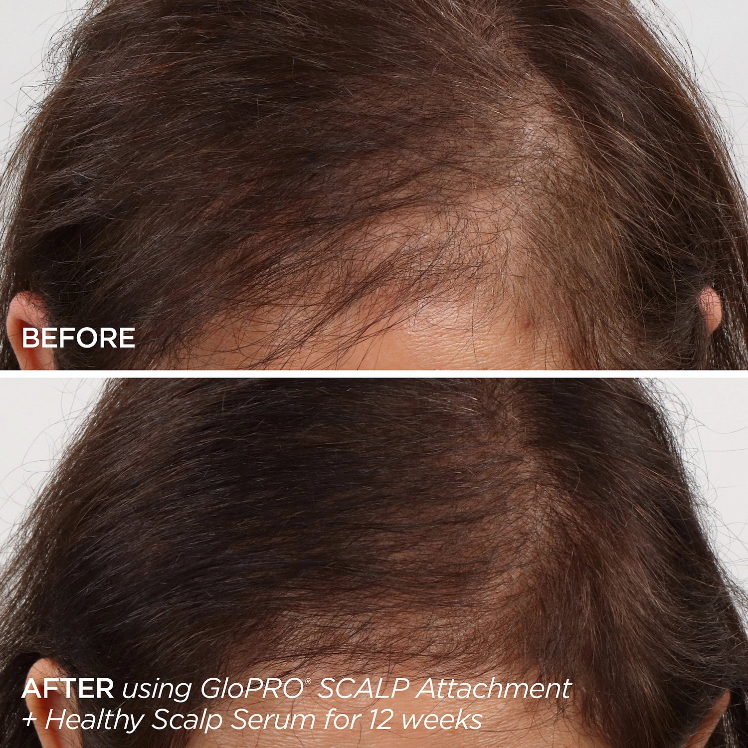 BeautyBio Rejuvenating Scalp + Fuller Hair Therapy Set - Image 4