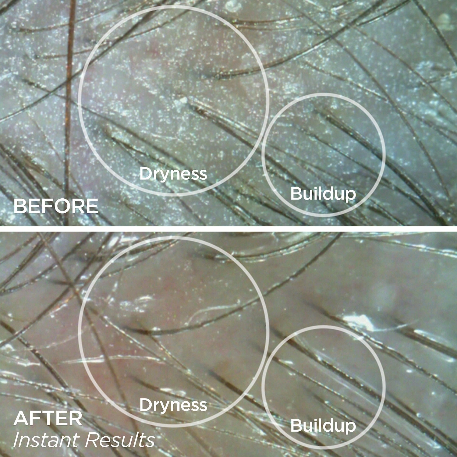 BeautyBio Rejuvenating Scalp + Fuller Hair Therapy Set - Image 10