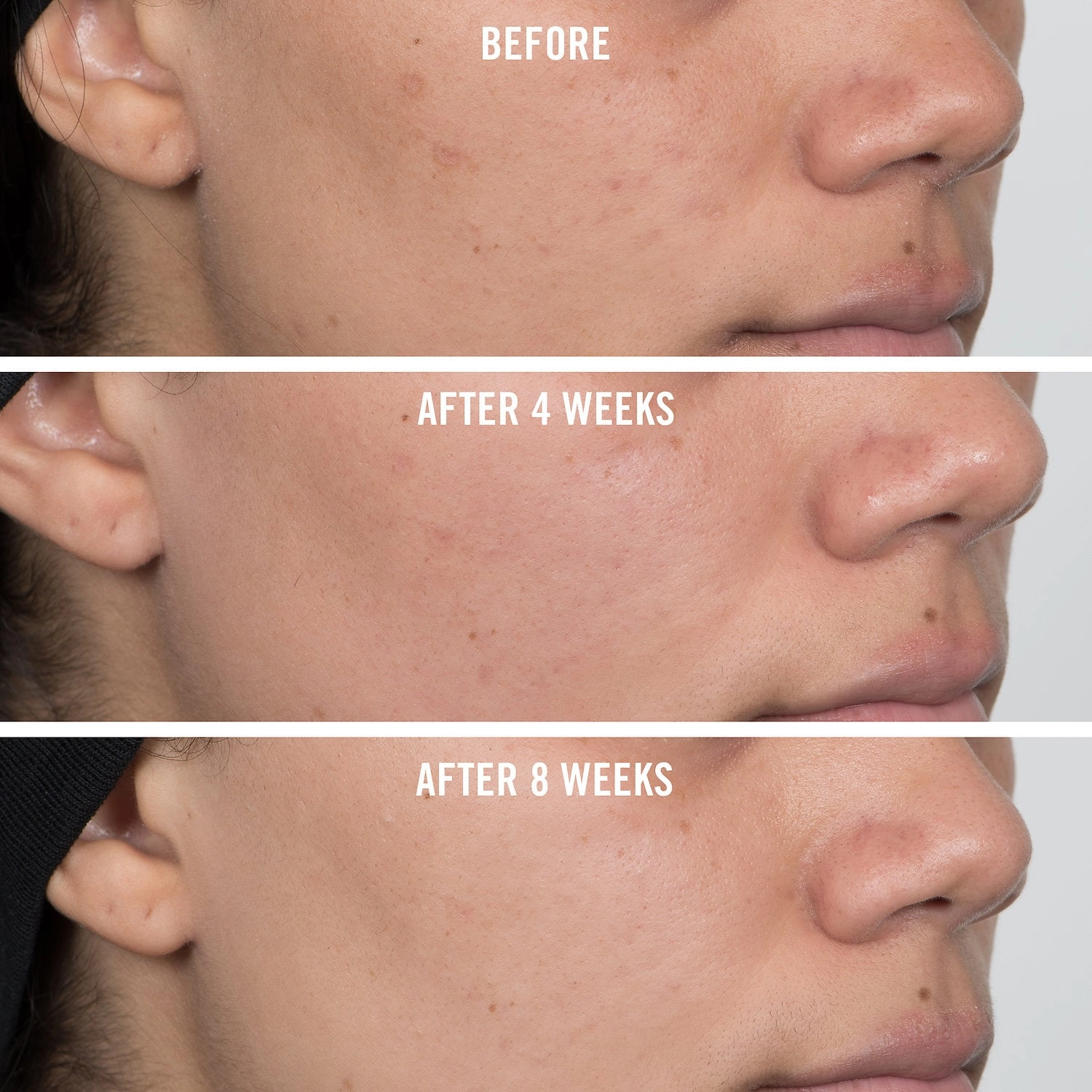 First Aid Beauty Facial Radiance Niacinamide Dark Spot Serum 1 oz/ 30 mL - Normal Skin - Image 7