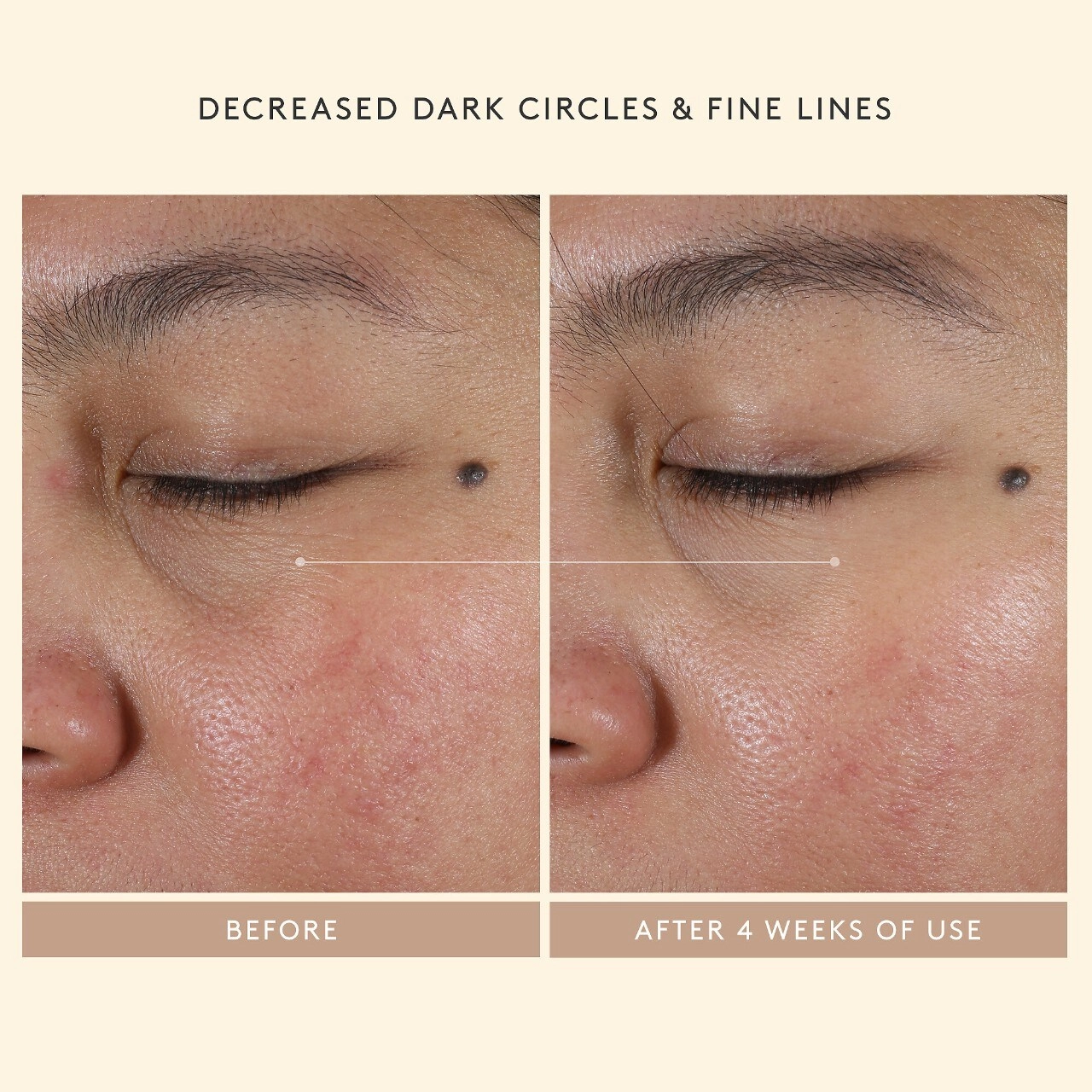 Shani Darden Skin Care Intensive Eye Renewal Cream with Firming Peptides 0.5 oz/15 mL - Image 2