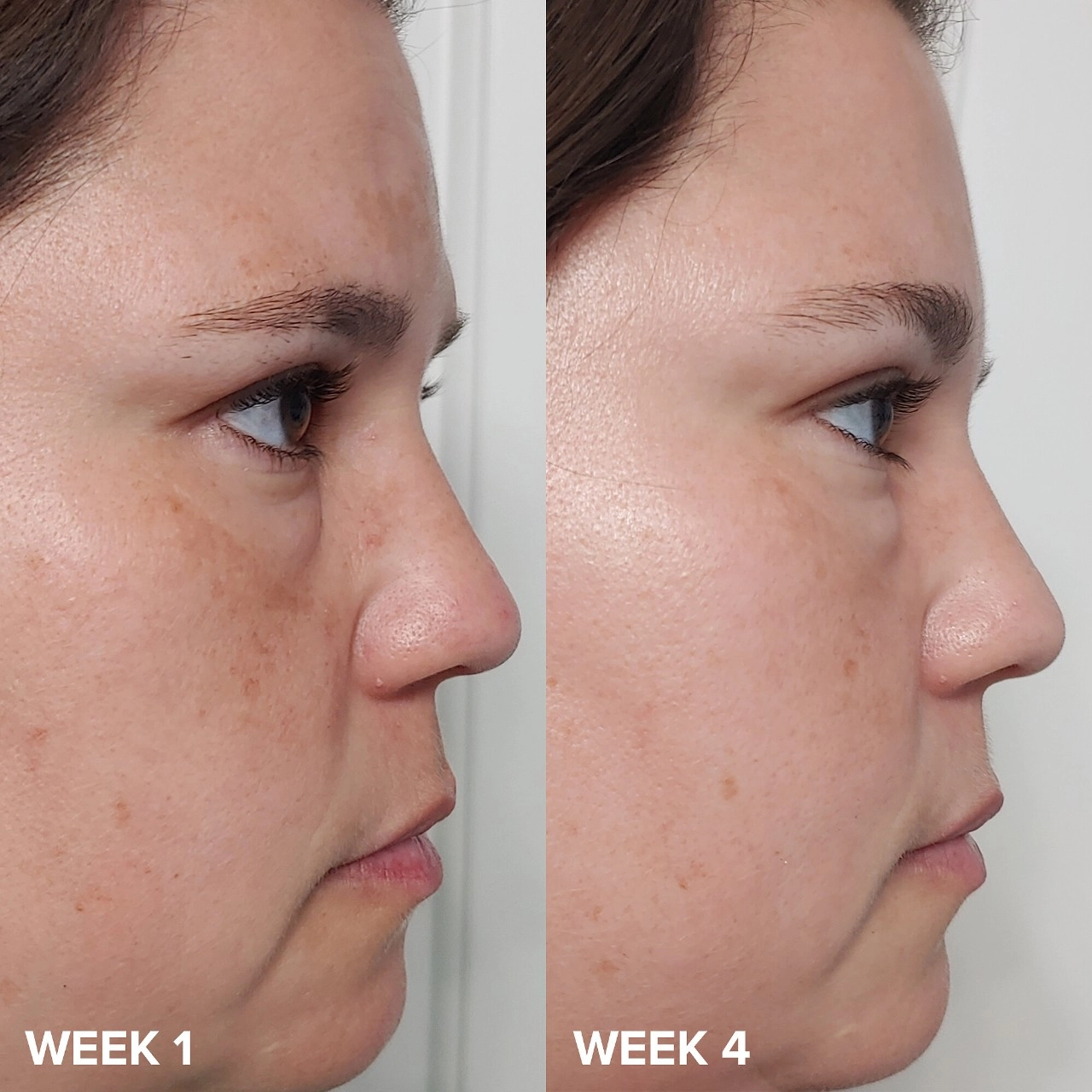 Paula's Choice Skin Perfecting 2% BHA Liquid Exfoliant - Pores, Acne, Salicylic Acid, 4 oz/118 mL - Image 2