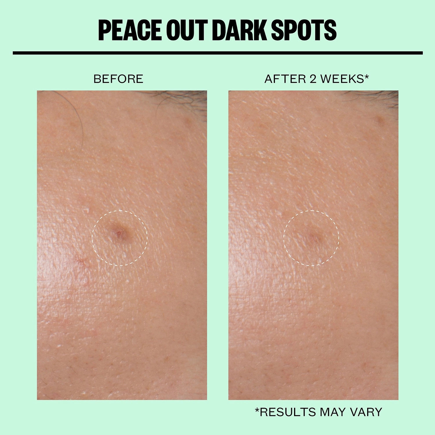 Peace Out Microneedling Dark Spot Brightening Dots with Hyaluronic Acid - Image 6