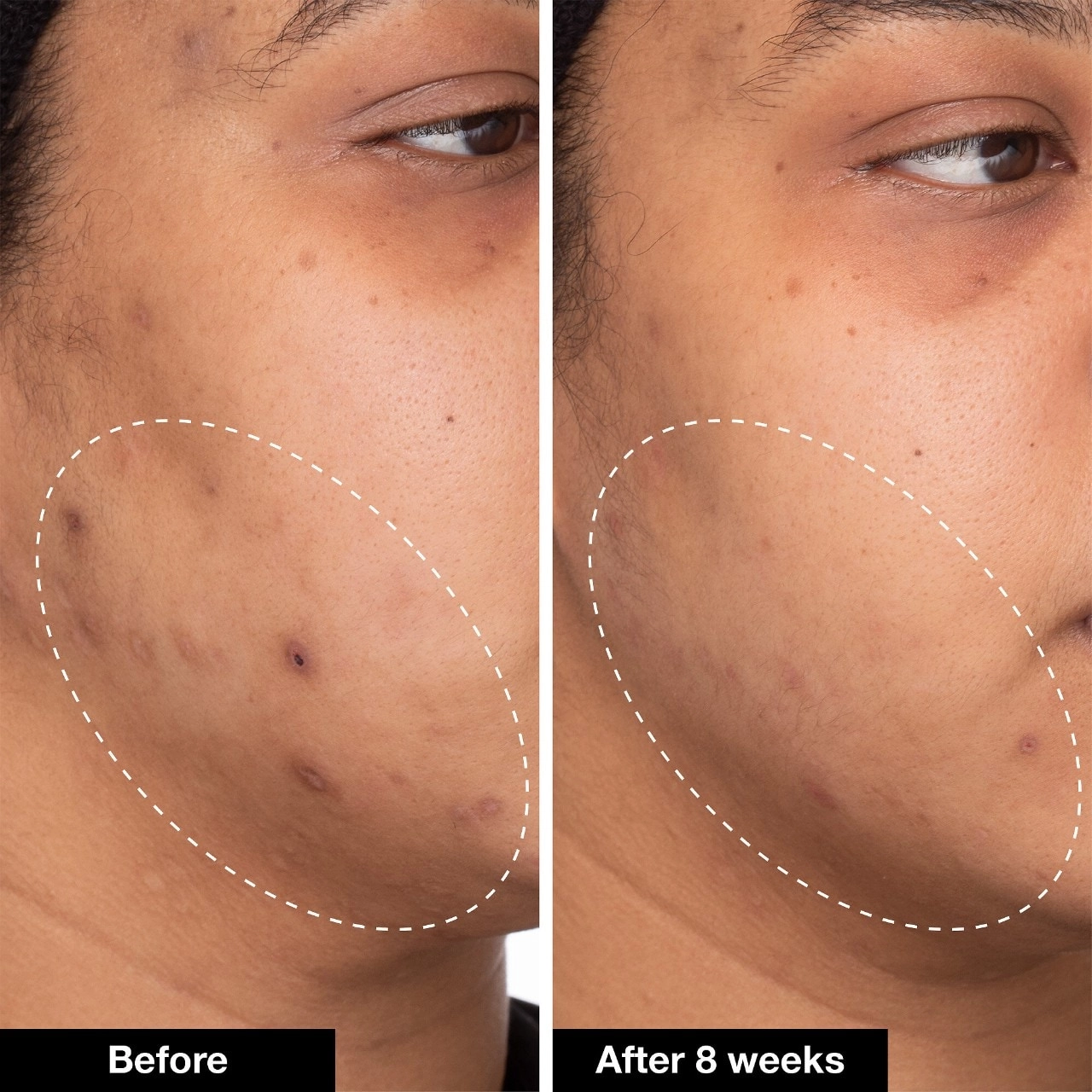 iNNBEAUTY PROJECT Green Machine Vitamin C Dark Spot & Hyperpigmentation Serum 1 oz/30 mL Vegan - Image 2