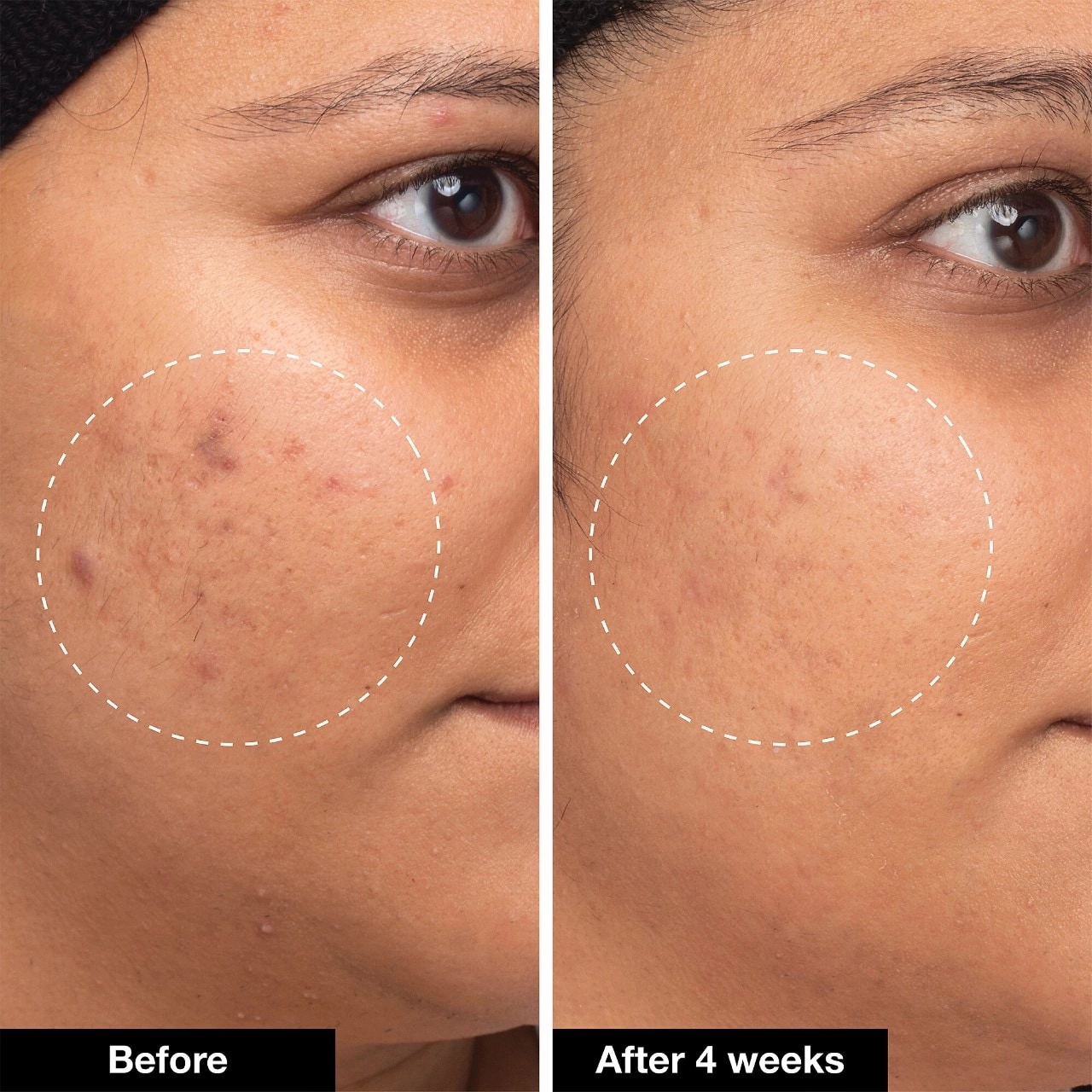 iNNBEAUTY PROJECT Green Machine Vitamin C Dark Spot & Hyperpigmentation Serum 1 oz/30 mL Vegan - Image 4