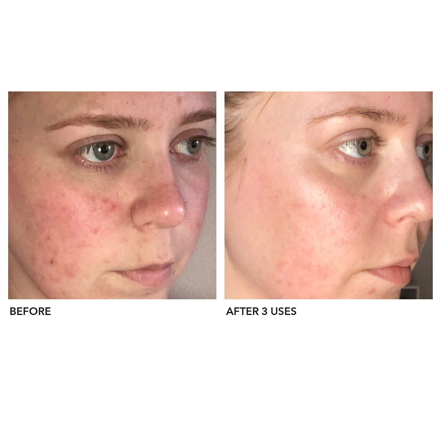 Algenist Blue Algae Vitamin C Brightening Peel 1.5 oz/45 mL - Image 2