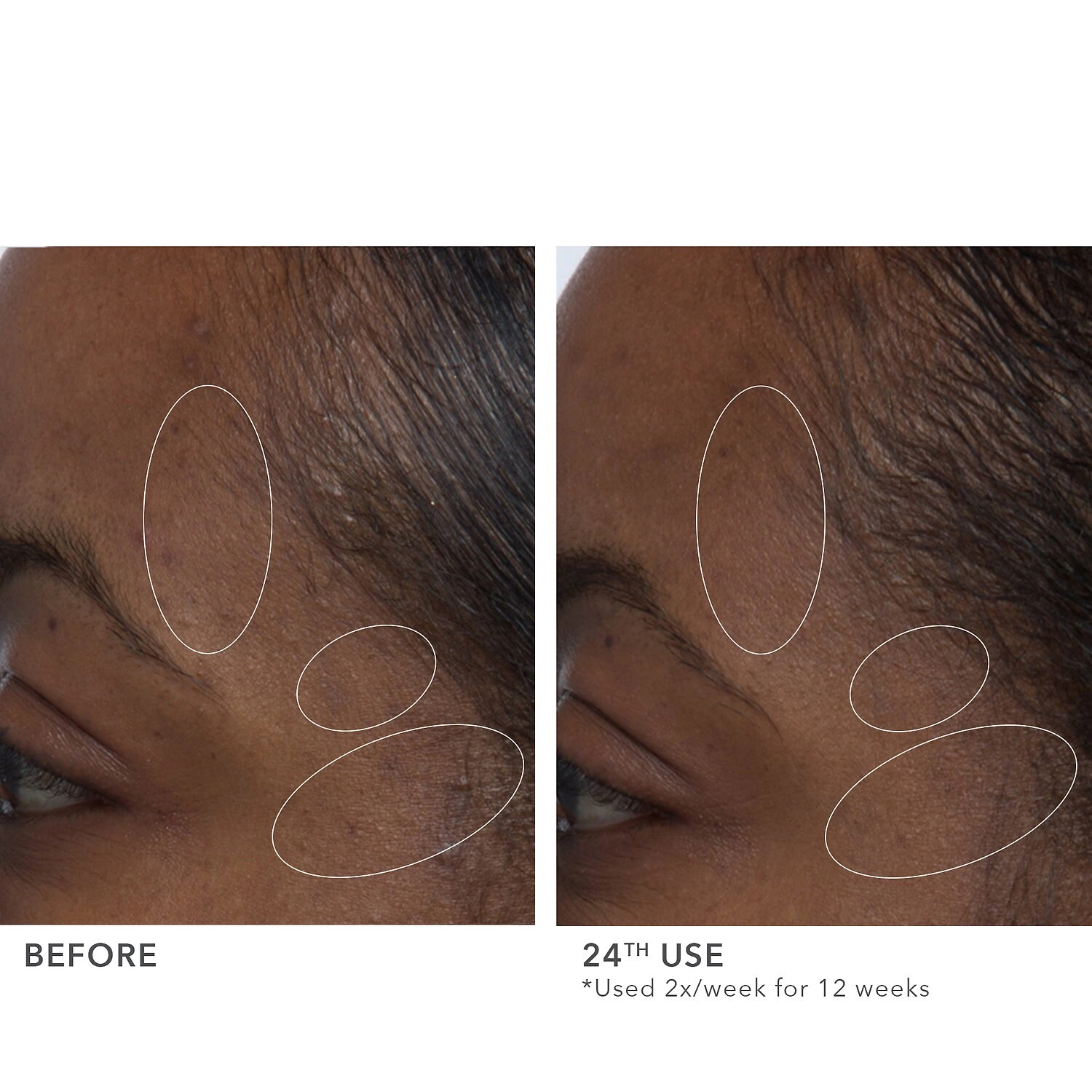 Algenist Blue Algae Vitamin C Brightening Peel 1.5 oz/45 mL - Image 7