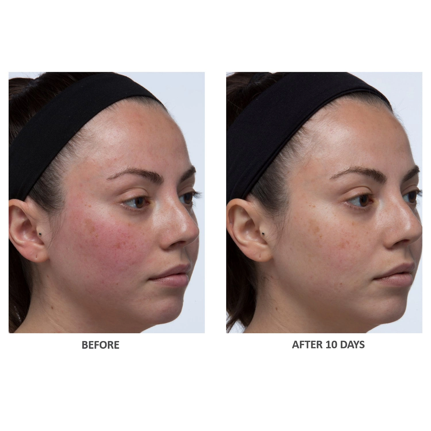 Algenist Blue Algae Vitamin C Skinclarity Brightening Serum 1 oz/30 mL - Image 6