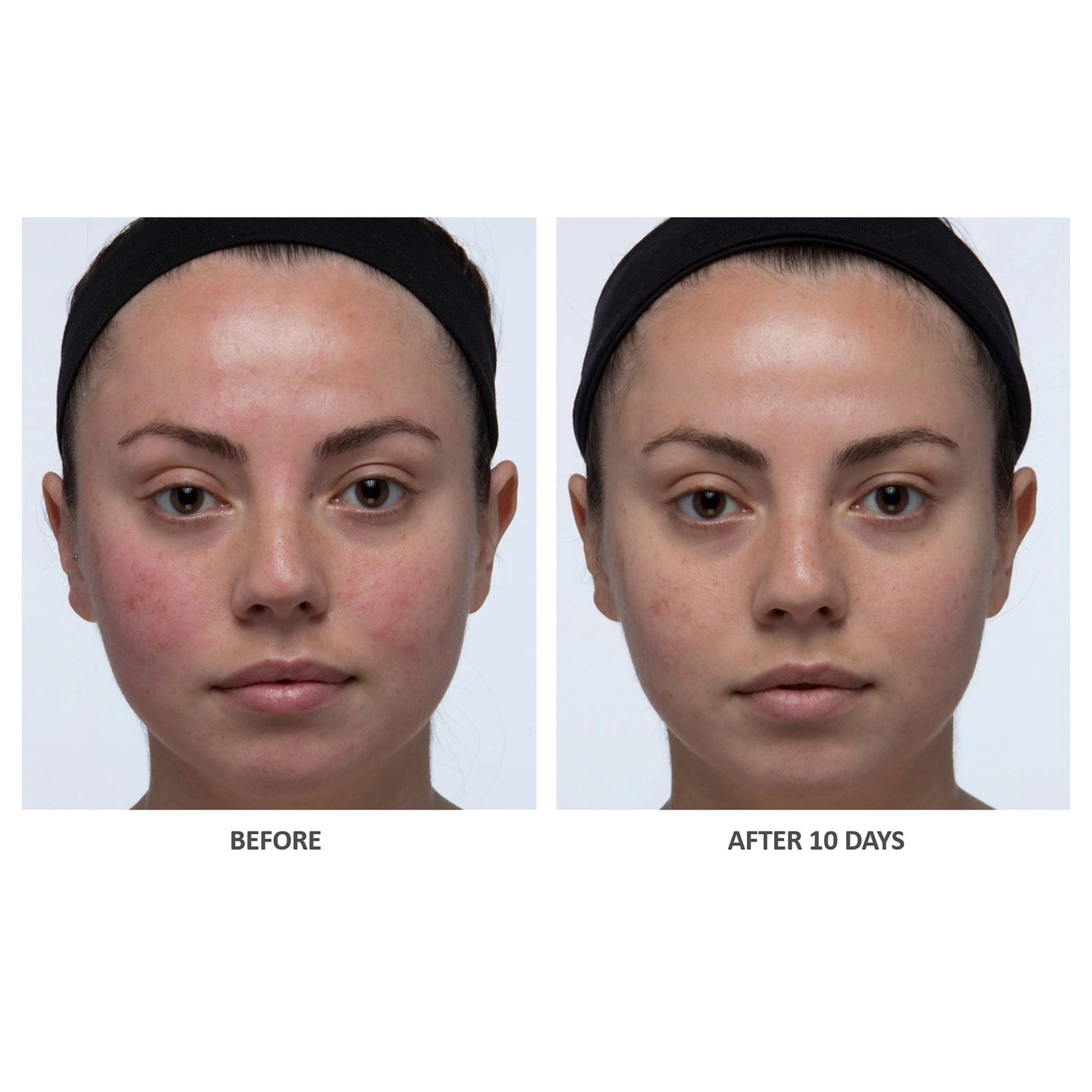 Algenist Blue Algae Vitamin C Skinclarity Brightening Serum 1 oz/30 mL - Image 5