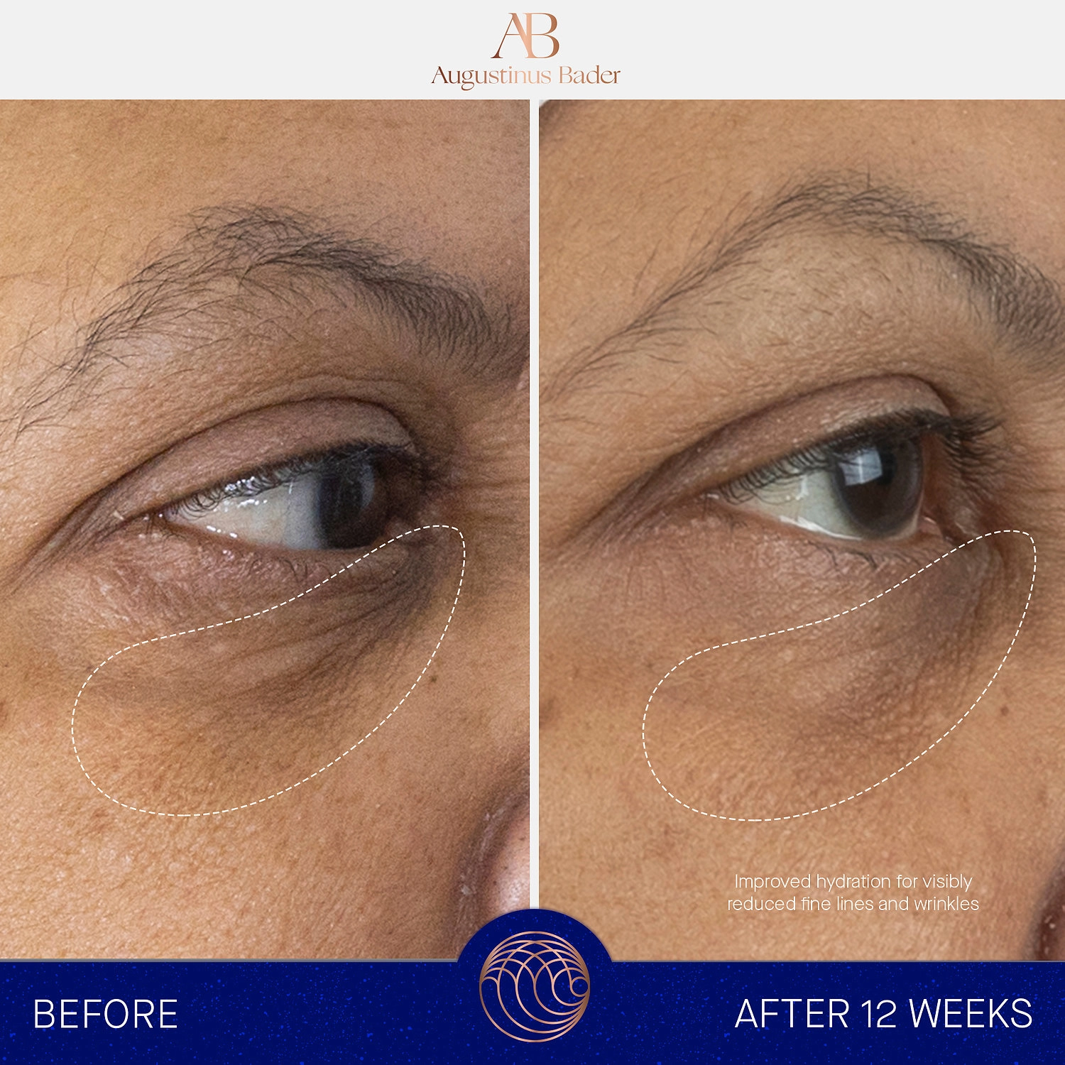 Augustinus Bader The Eye Cream with TFC8® 0.5 oz/15 mL Vegan Dark Circles Anti-Aging - Image 2