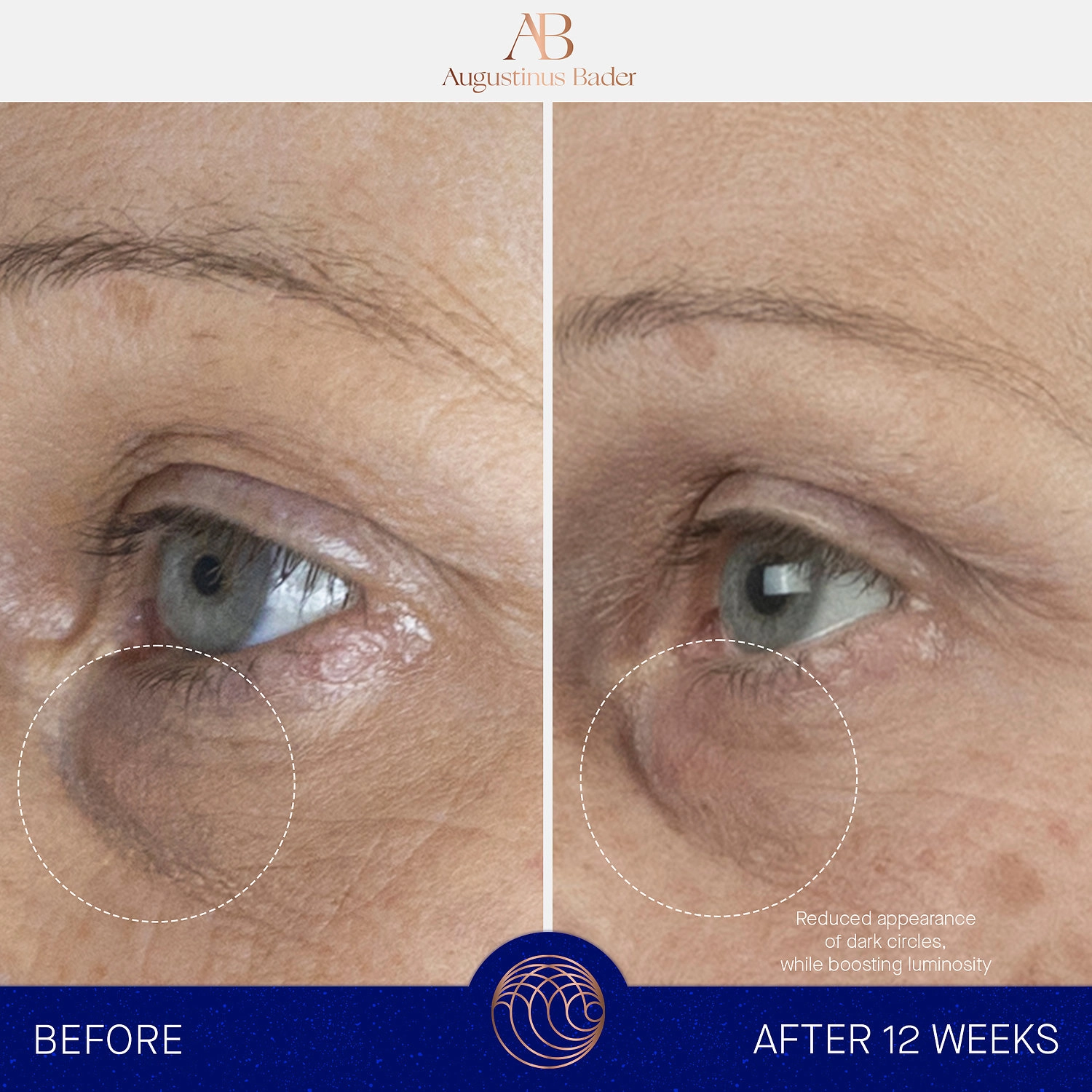 Augustinus Bader The Eye Cream with TFC8® 0.5 oz/15 mL Vegan Dark Circles Anti-Aging - Image 3