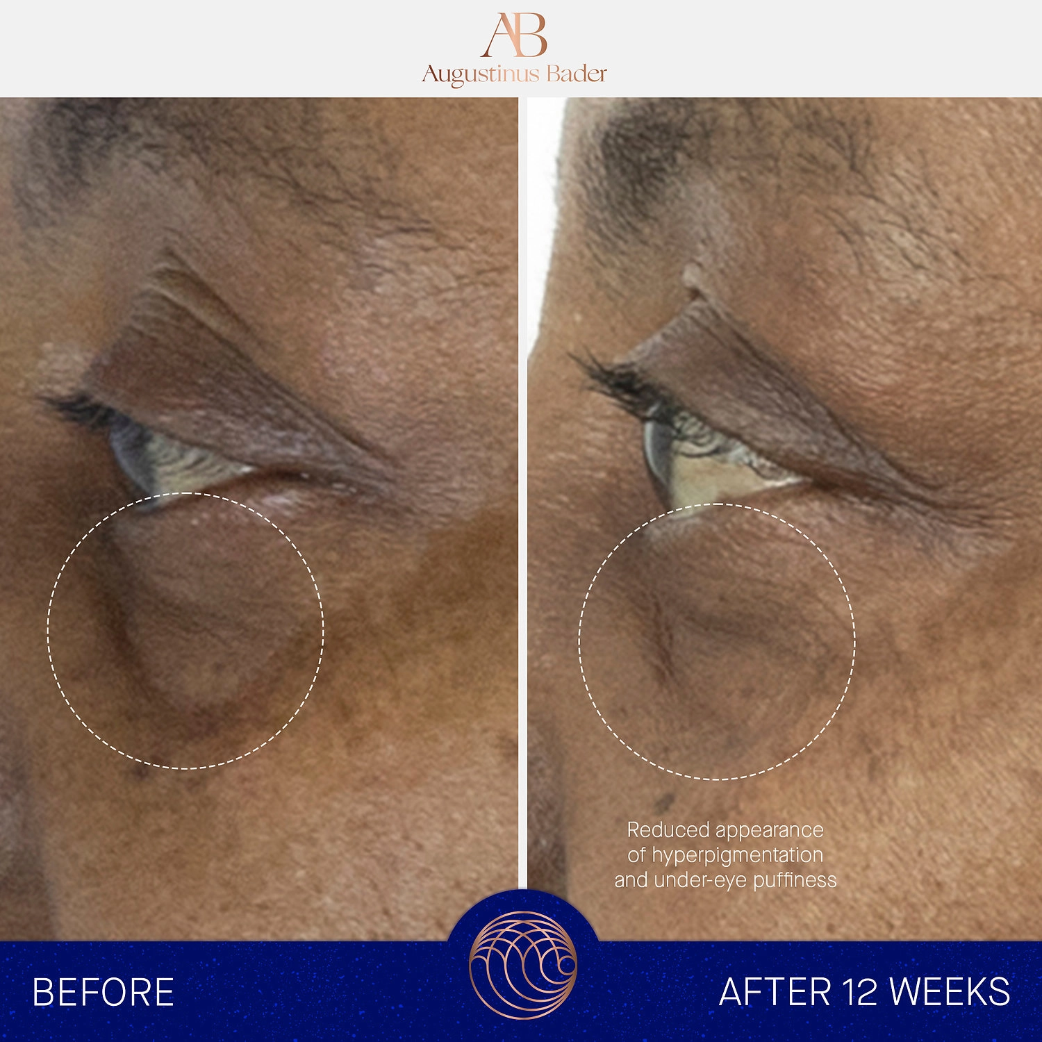 Augustinus Bader The Eye Cream with TFC8® 0.5 oz/15 mL Vegan Dark Circles Anti-Aging - Image 4