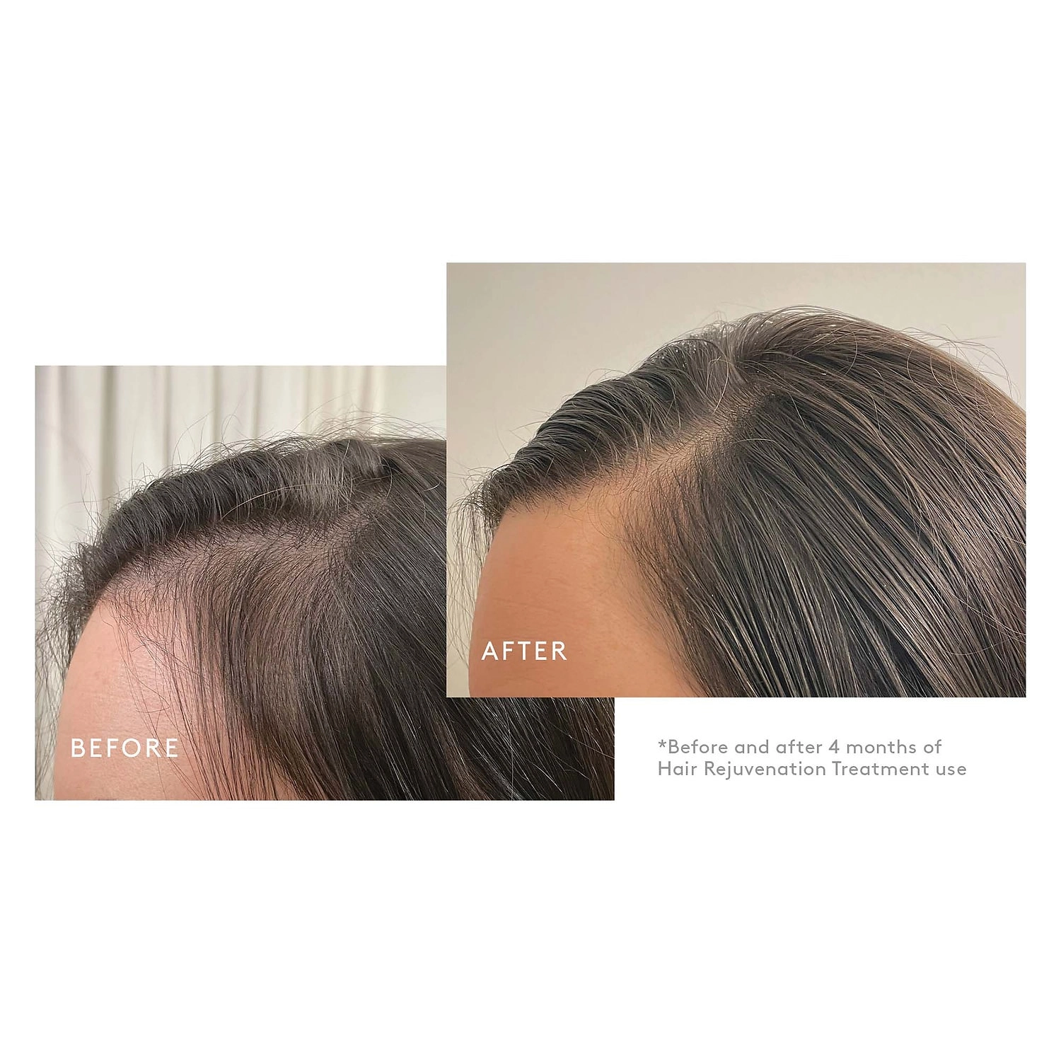 Virtue Flourish® Hair Rejuvenation Treatment Set for Volume - 90 Day Supply - Image 3