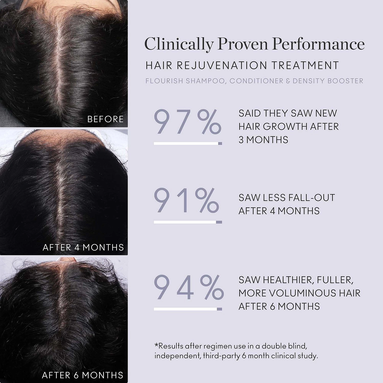 Virtue Flourish® Hair Rejuvenation Treatment Set for Volume - 90 Day Supply - Image 2