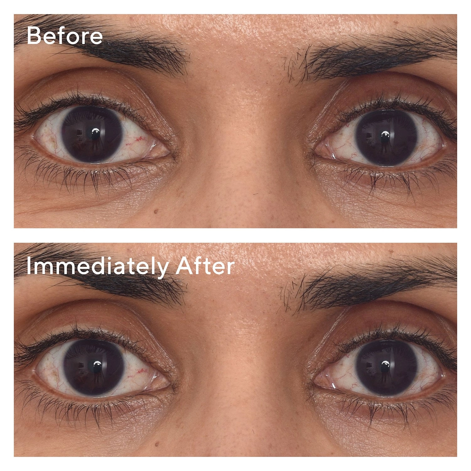 Murad Retinol Youth Renewal Eye Masks Size: 1 Pair - Image 3