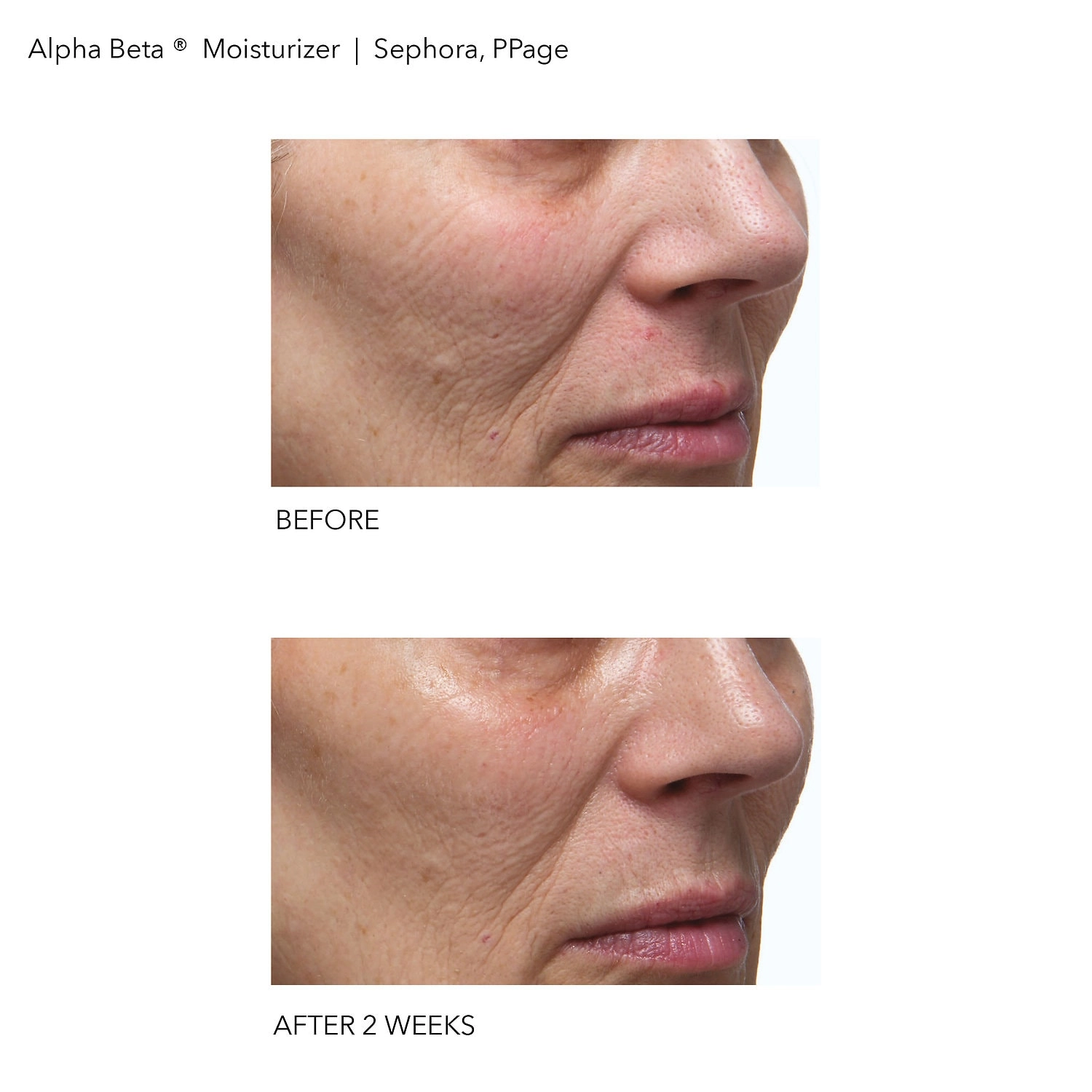 Dr. Dennis Gross Skincare Alpha Beta® Daily Moisturizer 1.7 oz/50 mL Lactic Acid AHA/Glycolic Acid - Image 3