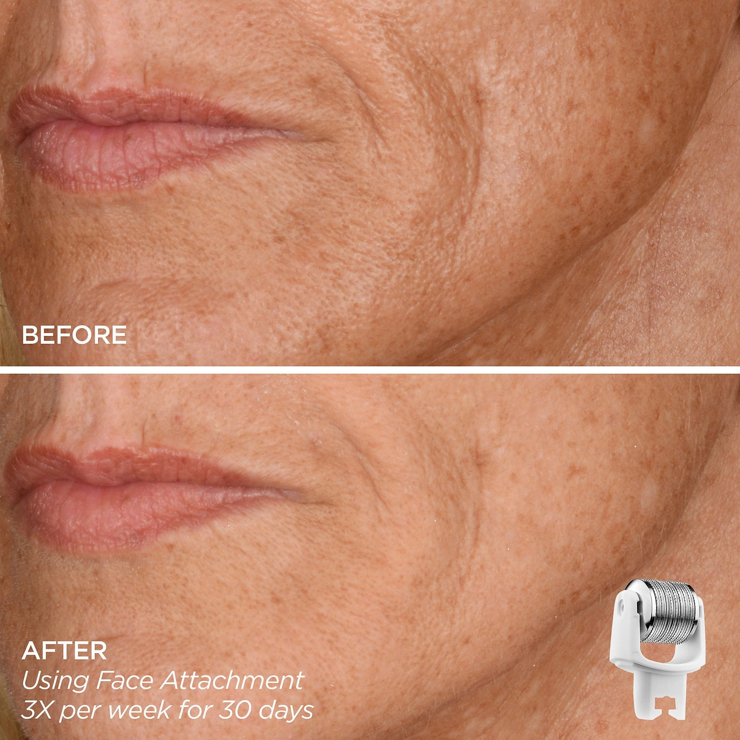 BeautyBio Eye Want It All Face + Eye Microneedling Set - Image 2