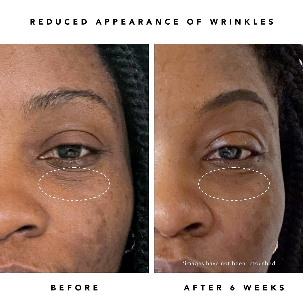 Herbivore Moon Fruit 1% Bakuchiol + Peptides Retinol Alternative Serum - Vegan - Image 5