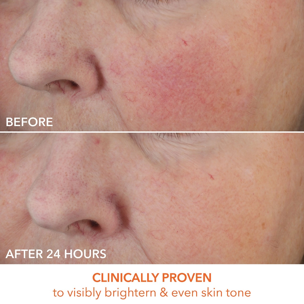 Dr. Dennis Gross Skincare Vitamin C Lactic Dewy Deep Cream Size: 2 oz / 60 mL - Image 2