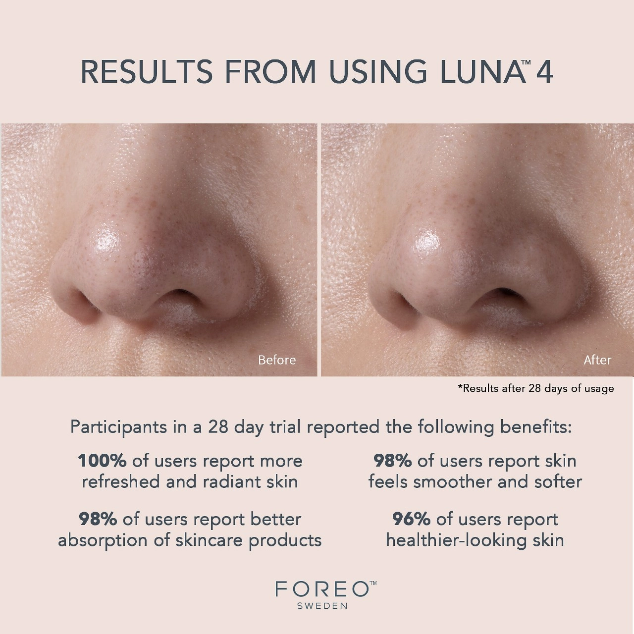 FOREO LUNA™ 4 Facial Cleansing & Firming Massage for Balanced Skin - Image 2