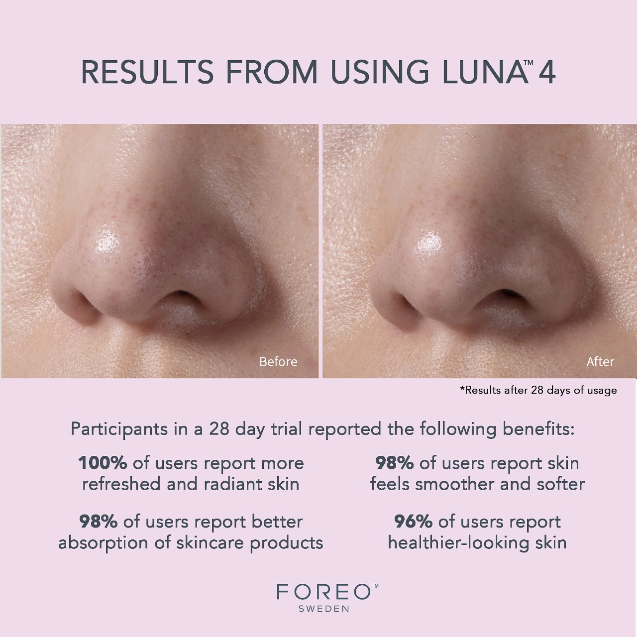 FOREO LUNA™ 4 Facial Cleansing & Firming Massage for Sensitive Skin - Image 2
